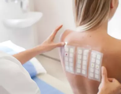 Hogyan kezeld az allergiát?